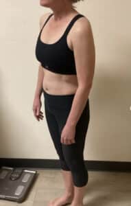 After Image: Semaglutide