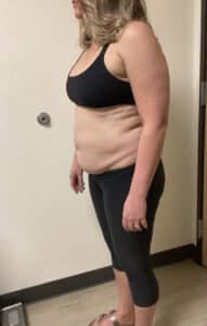 Before Image: Semaglutide